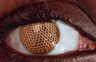 A close up of an eye with a honeycomb centre